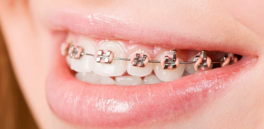 Miami Orthodontic Specialists | Orthodontist in Miami
