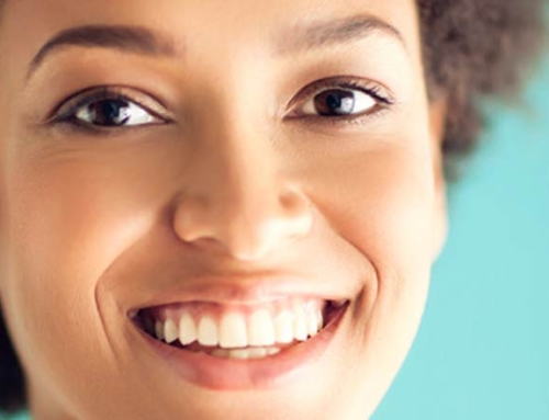 What To Know Before Getting Invisalign